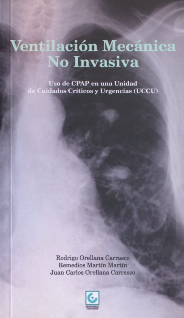 Ventilación mecánica no invasiva. Uso de CPAP en una Unidad de Ciudados Intensivos y Urgencias